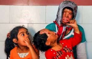 attaque acide fillette