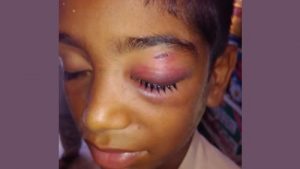 2016101494433677513031