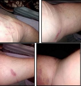 torture prisonnier psycho malade