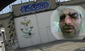 bouche et paupières cousues