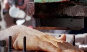 hand amputation Iran 500x300