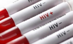 HIV 500x300