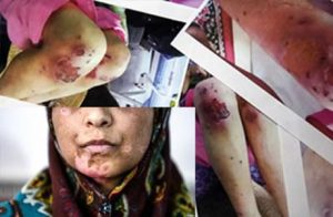 Provision Security Women