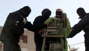 amputation-iran-csdhi