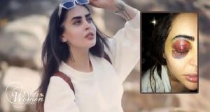 Mina-Yaghoubi-entraineuse-de-culturisme-iran-csdhi