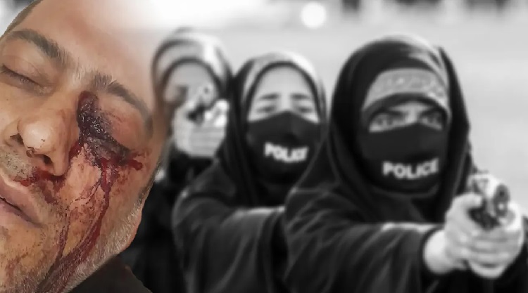 Tirer dans les yeux iran csdhi