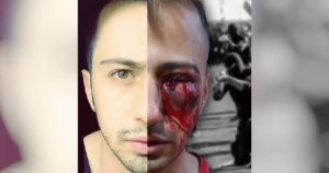 balles-de-plomb-saman-iran-csdhi.