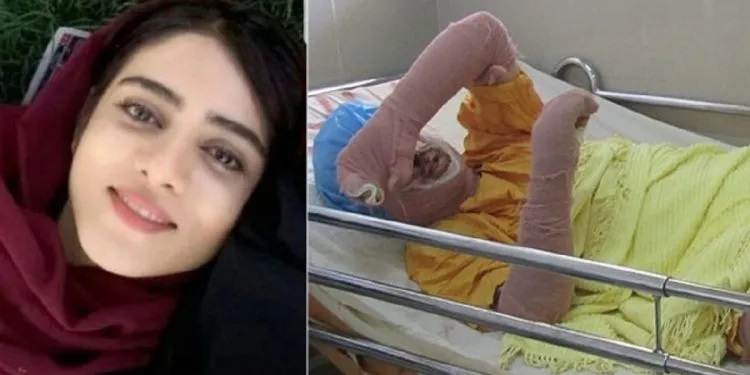 fille-bleue-iran-csdhi