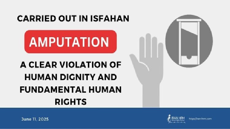peines-d-amputation-iran-csdhi
